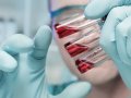 Role of Clinical Biomarkers in the Treatment of Breast Cancer