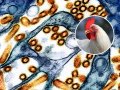 First Human Cases of Bird Flu in California Confirmed