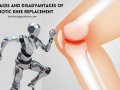 ADVANTAGES AND DISADVANTAGES OF ROBOTIC KNEE REPLACEMENT