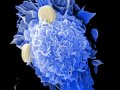 The Impact of Protocol Amendments on Clinical Trial Data Flow and Timelines
