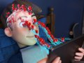 How is AI transforming the healthcare industry