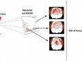 Inside the brains of killer bees