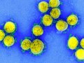 Coronavirus antigen tests: quick and cheap, but too often wrong?