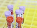 The Evolving Complexity of Clinical Trials and the Role of ADaMIG in Data Analysis