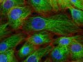 A Comprehensive Guide to Annotating and Mapping Clinical Research Forms in PDFs