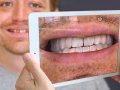 Smile, you’re in augmented reality dentistry