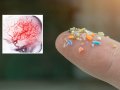 Microplastics May Block Blood Flow in the Brain