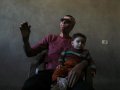 Gaza burn victims get 3D-printer face masks made close to home