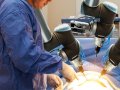 How are Robotic-Assisted Laparoscopy Devices Playing an Important Role in Surgical Operations?