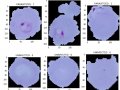 Automatic Malaria Detection Using Neural Network