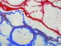 One Test to Rule Them All: The End of Diagnostic Guesswork