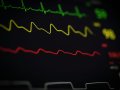 Pan-Tompkins Algorithm for Detecting QRS Waves