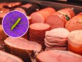 Listeria Symptoms to Watch Out for as Deli Outbreak Kills 2, Recalls Issued