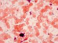 Fecal Transplants May Reverse Brain Aging in Mice